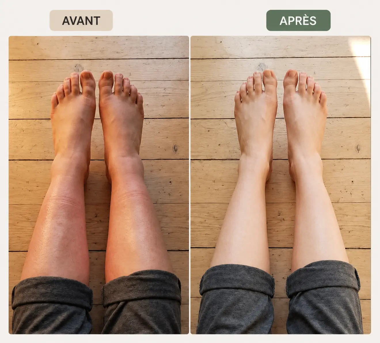 Drainant Lymphatique BelGlow — Complexe Lympha-4